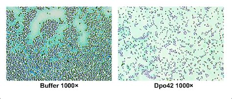 e coli capsule stain